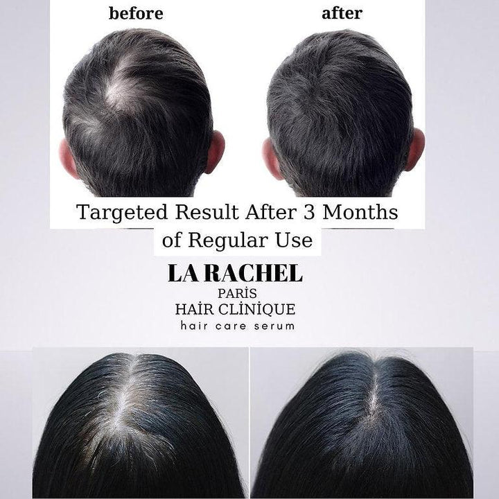 La Rachel Paris Miraculous hair serum that reduces hair loss by 99% and creates 121% new hair - Lujain Beauty