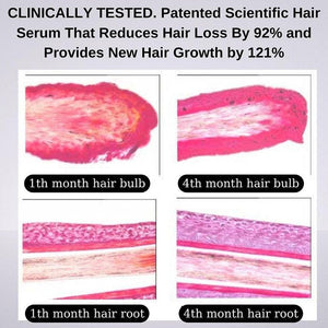La Rachel Paris Miraculous hair serum that reduces hair loss by 99% and creates 121% new hair - Lujain Beauty